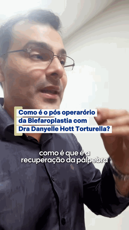 Como é o pós-operatório da blefaroplastia: pontos, inchaço e recuperação — Rio de Janeiro