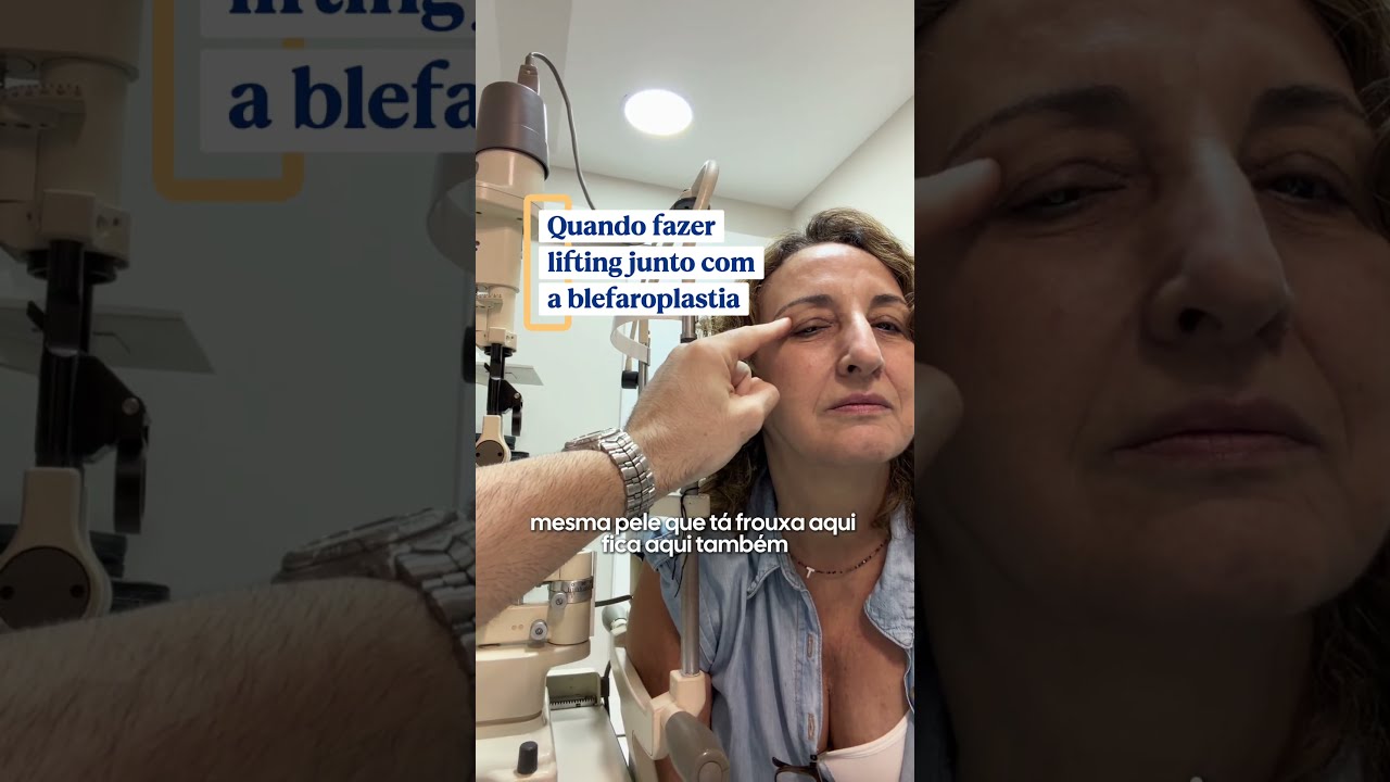 Blefaroplastia com lifting: quando é indicado? - Hott Torturella - Rio de Janeiro