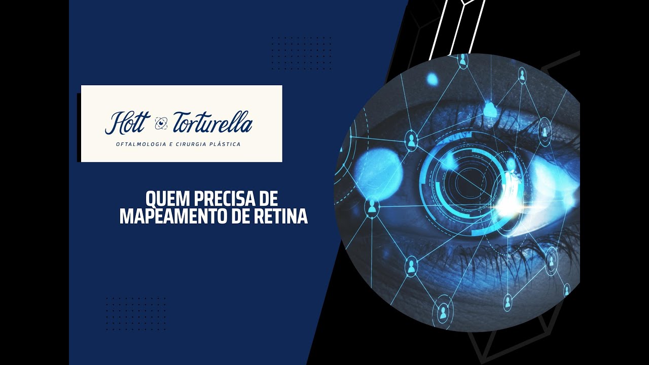 Mapeamento de Retina Dr Vitor Torturella