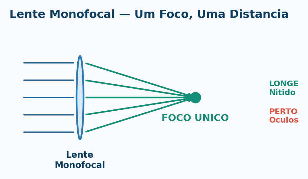 Diagrama óptico da lente monofocal para catarata: foca em apenas uma distância